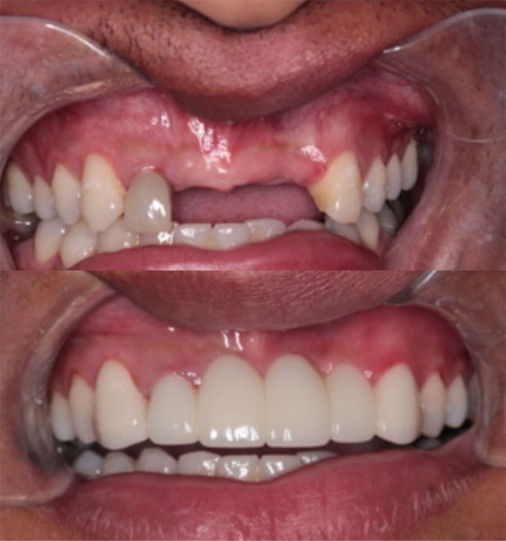 Before and After #1 Photo