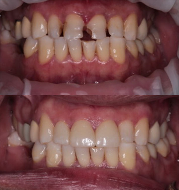 Before and After #10 Photo