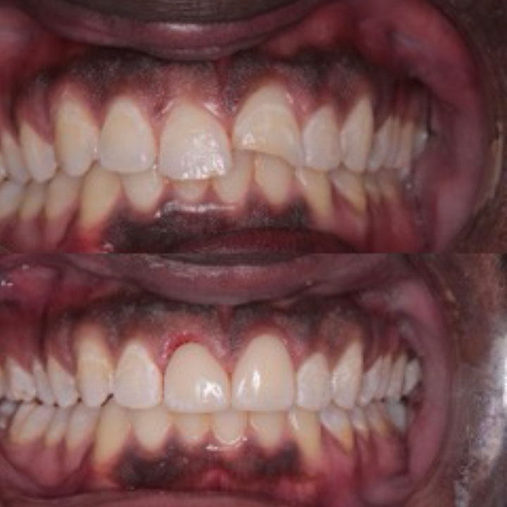 Before and After #12 Photo