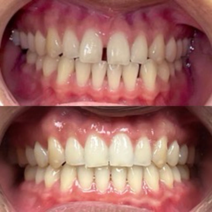 Before and After #14 Photo