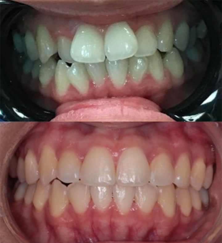 Before and After #2 Photo