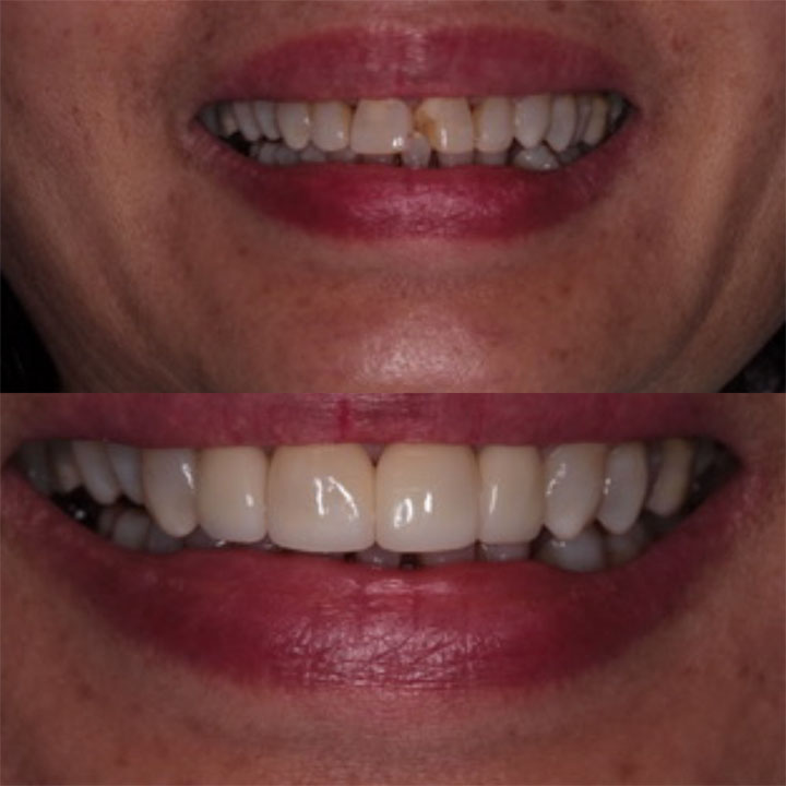 Before and After #3 Photo