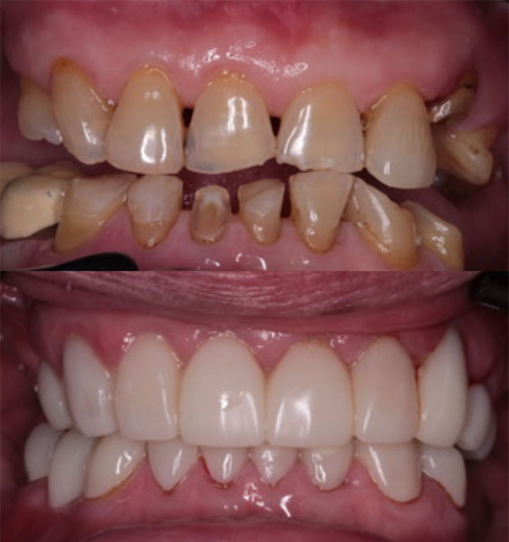Before and After #4 Photo
