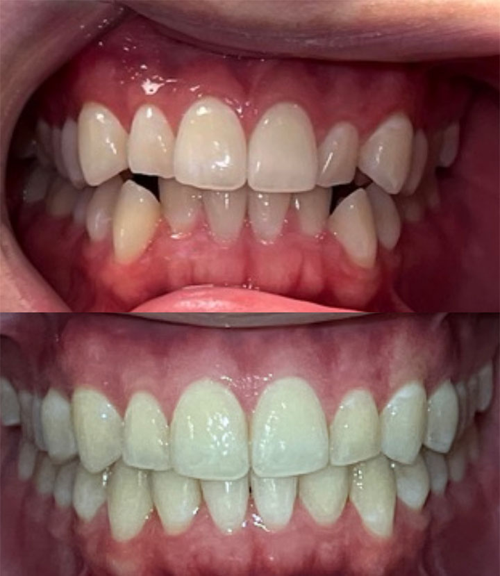 Before and After #5 Photo