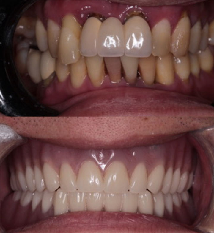 Before and After #6 Photo