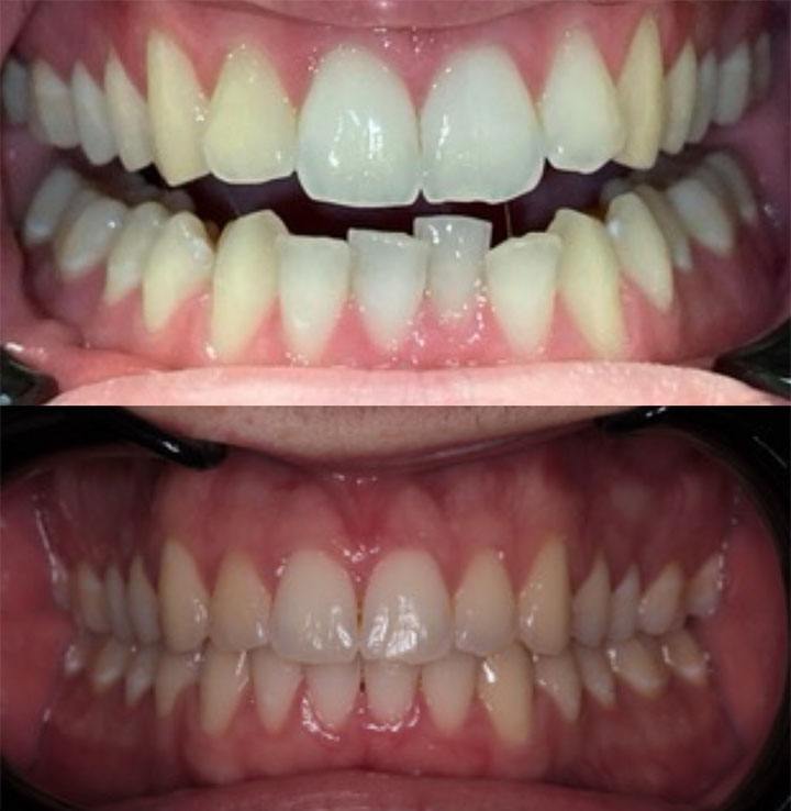 Before and After #7 Photo