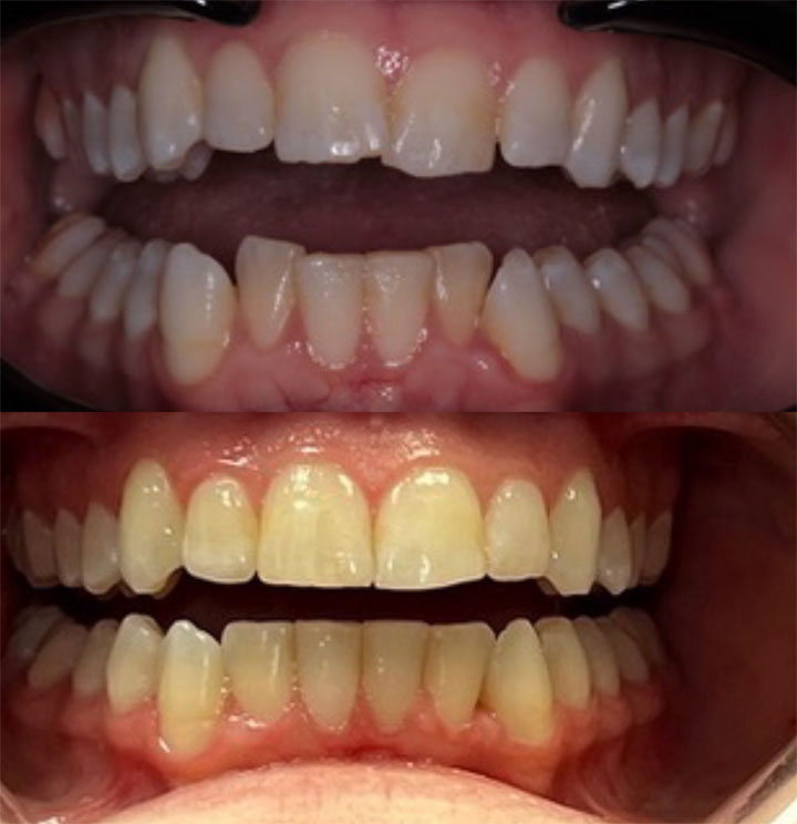 Before and After #8 Photo