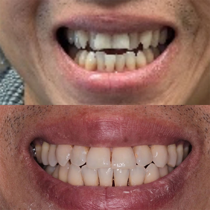 Before and After #9 Photo